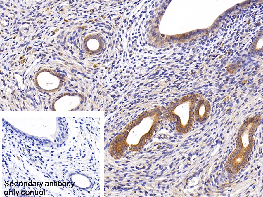 Polyclonal Antibody to Cytokeratin 18 (CK18)