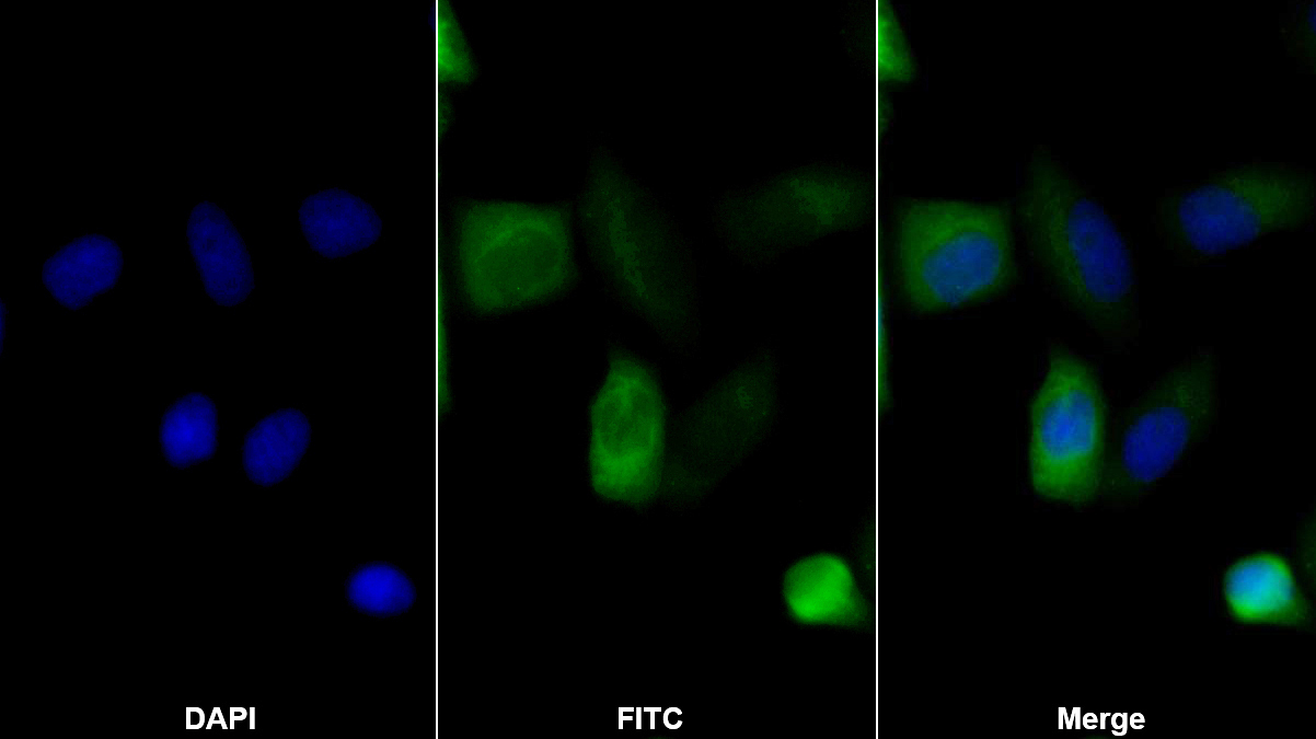 Polyclonal Antibody to Cytokeratin 18 (CK18)