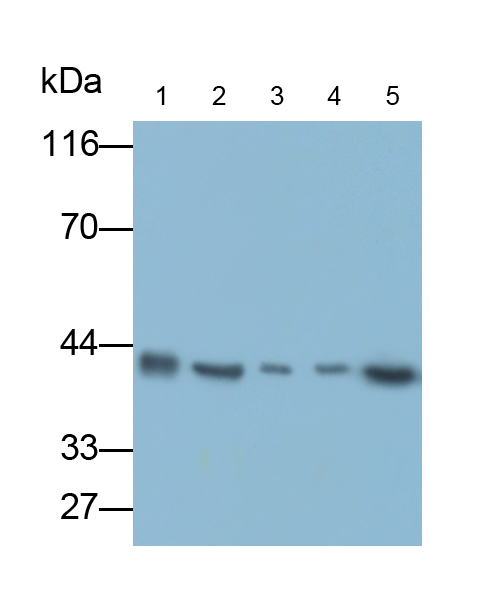 Polyclonal Antibody to Cytokeratin 18 (CK18)