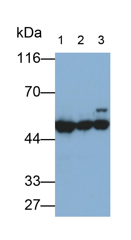 Polyclonal Antibody to Cytokeratin 18 (CK18)