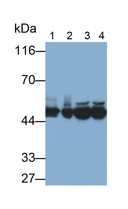 Polyclonal Antibody to Cytokeratin 18 (CK18)