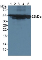 Polyclonal Antibody to Cytokeratin 18 (CK18)