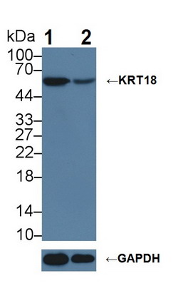 Polyclonal Antibody to Cytokeratin 18 (CK18)