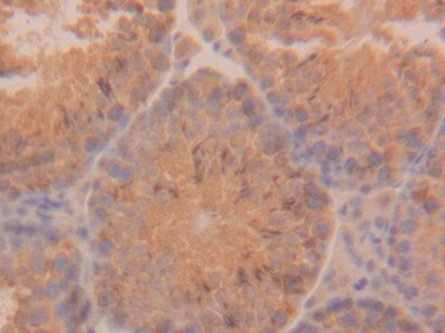 Polyclonal Antibody to Cytokeratin 18 (CK18)