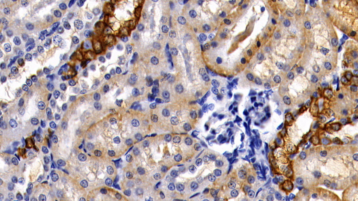 Polyclonal Antibody to Cytokeratin 18 (CK18)