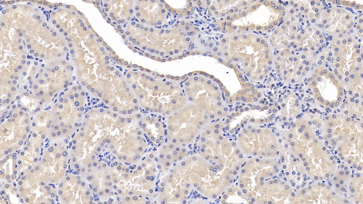 Polyclonal Antibody to Plasminogen (Plg)