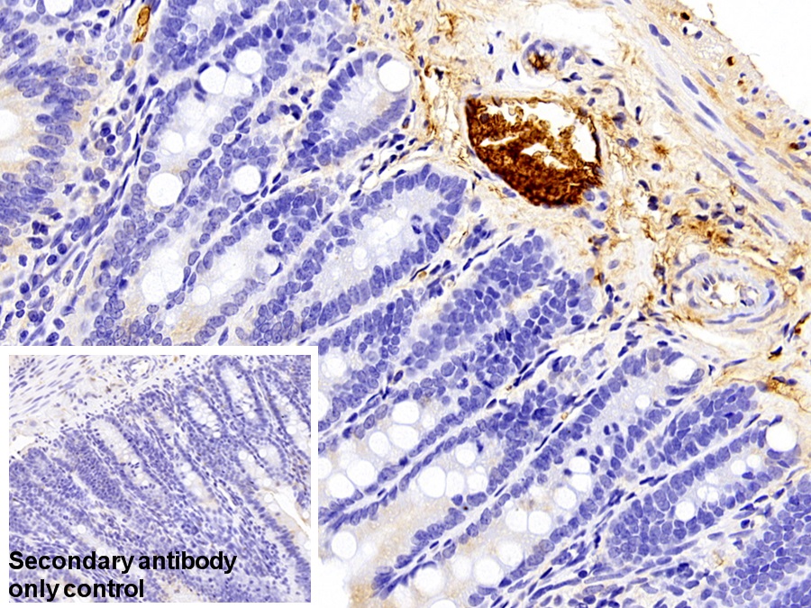 Polyclonal Antibody to Fibrinopeptide A (FPA)