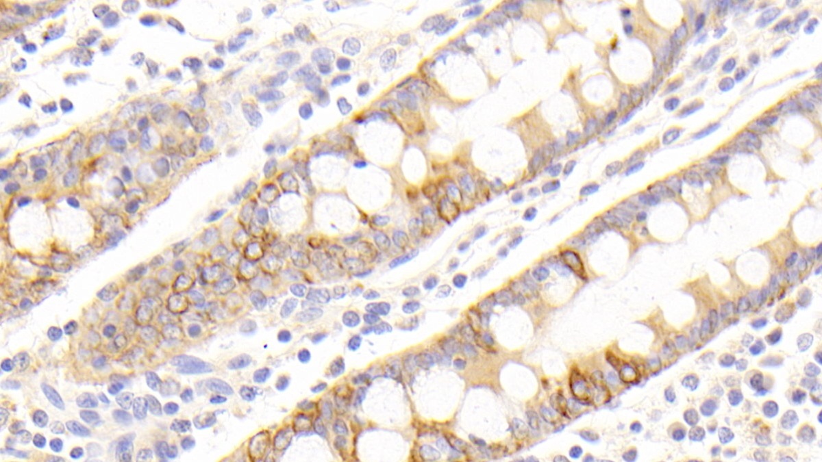 Polyclonal Antibody to Cytokeratin 19 (CK19)