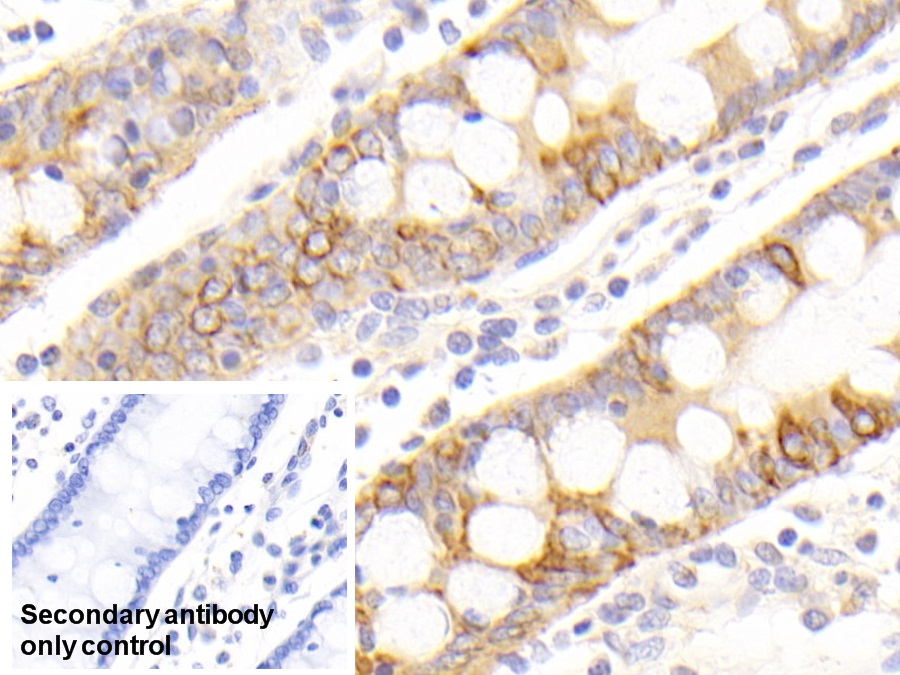 Polyclonal Antibody to Cytokeratin 19 (CK19)