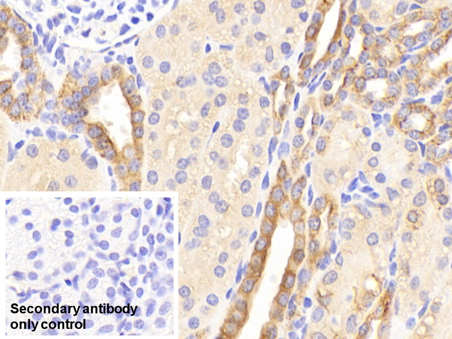 Polyclonal Antibody to Cytokeratin 19 (CK19)