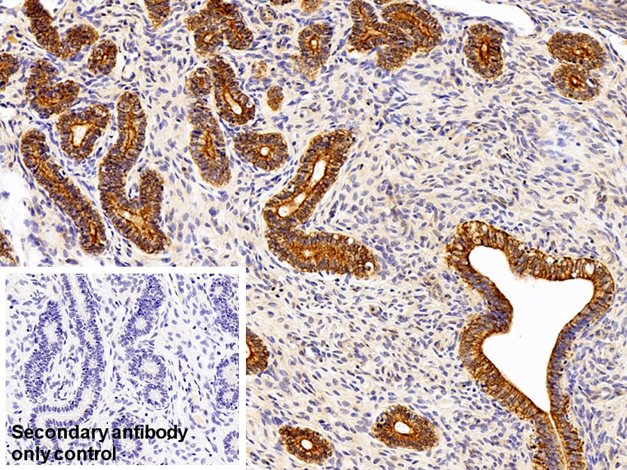 Polyclonal Antibody to Cytokeratin 19 (CK19)