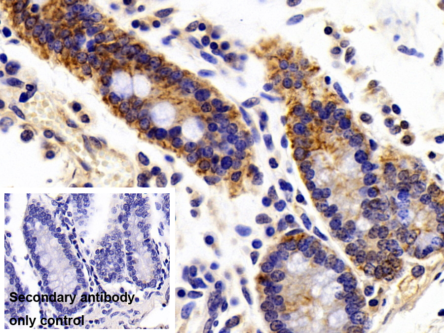 Polyclonal Antibody to Cytokeratin 19 (CK19)