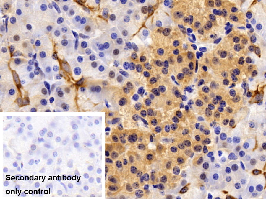 Polyclonal Antibody to Cytokeratin 19 (CK19)