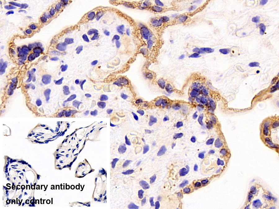 Polyclonal Antibody to Cytokeratin 19 (CK19)