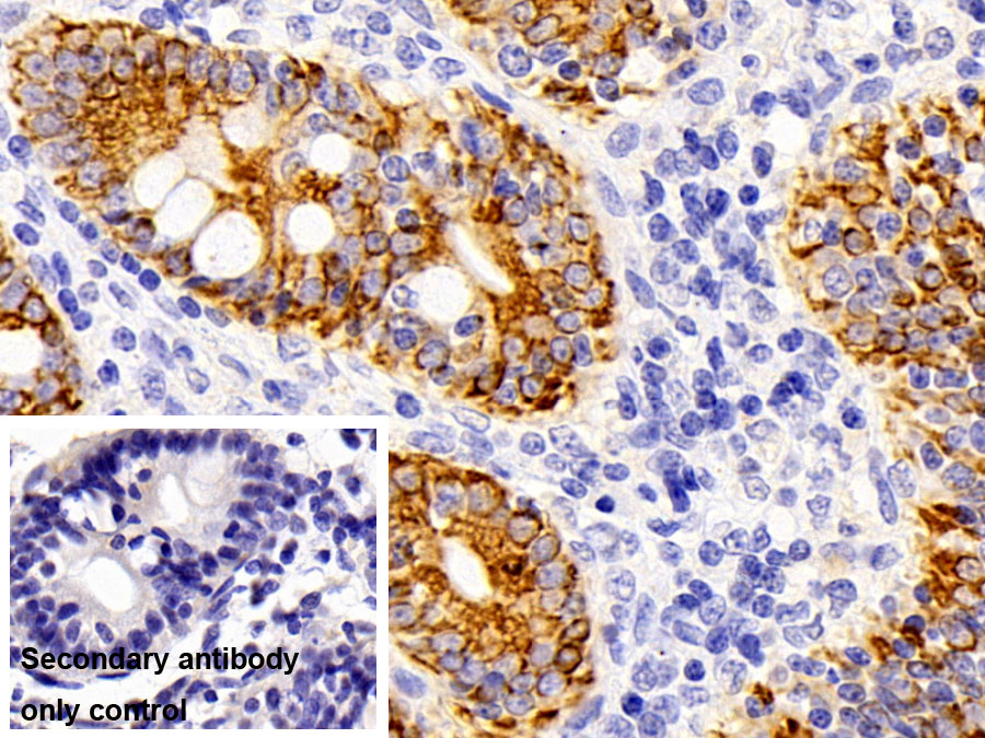 Polyclonal Antibody to Cytokeratin 19 (CK19)