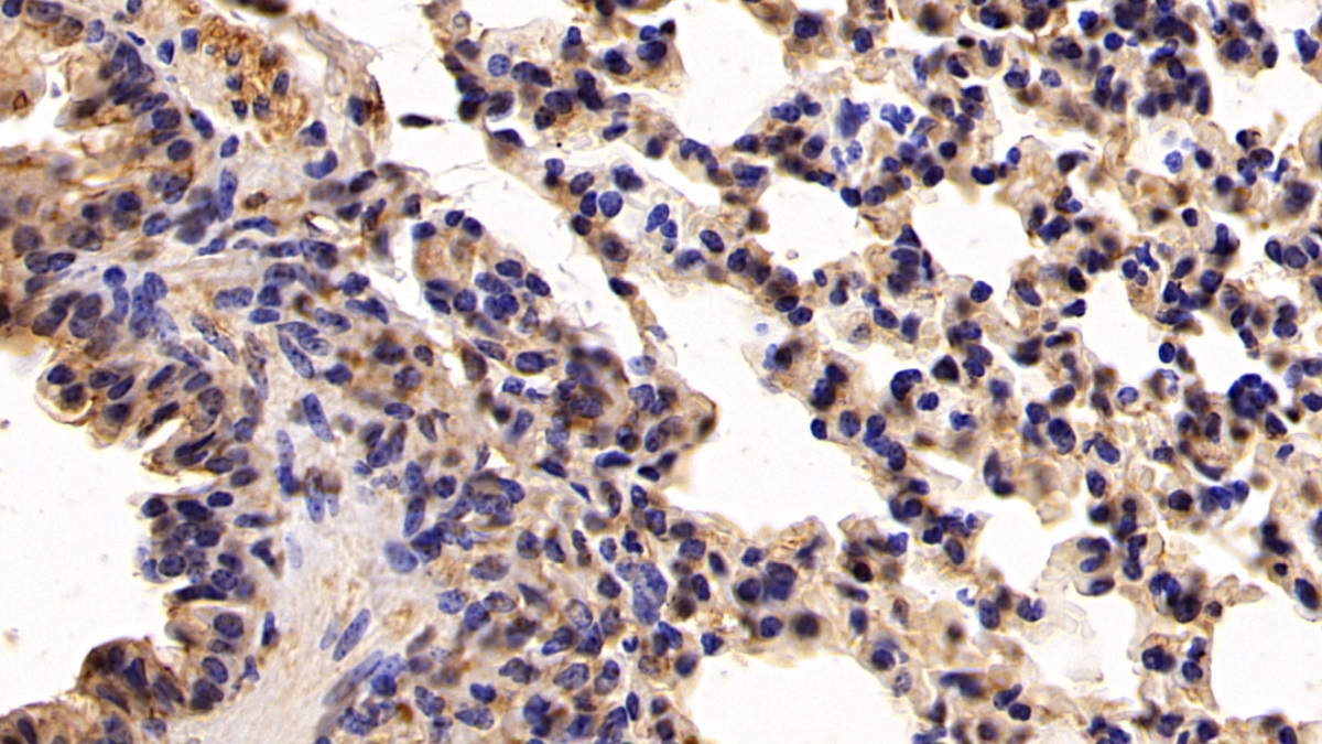 Polyclonal Antibody to Cytokeratin 19 (CK19)