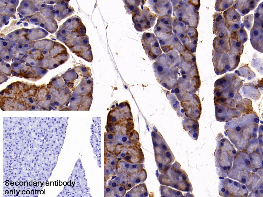 Polyclonal Antibody to Cytokeratin 19 (CK19)