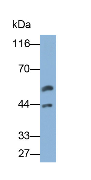 Polyclonal Antibody to Cytokeratin 19 (CK19)