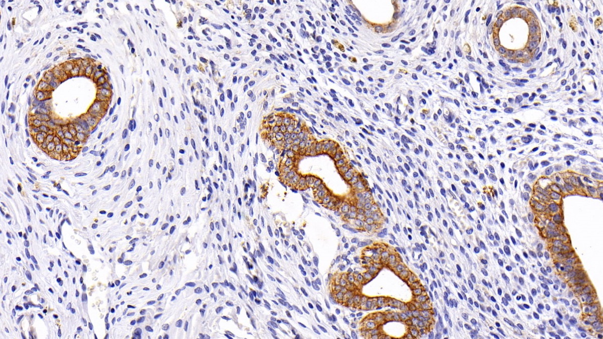 Polyclonal Antibody to Cytokeratin 19 (CK19)