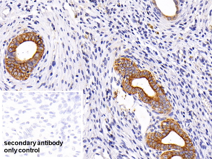 Polyclonal Antibody to Cytokeratin 19 (CK19)