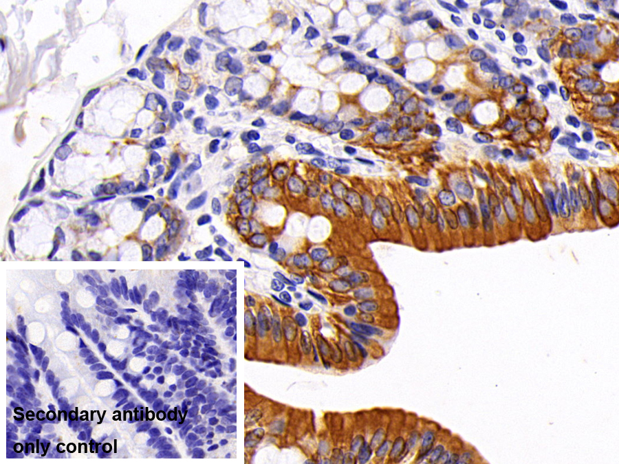 Polyclonal Antibody to Cytokeratin 19 (CK19)