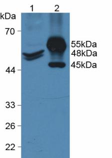 Polyclonal Antibody to Cytokeratin 20 (CK 20)