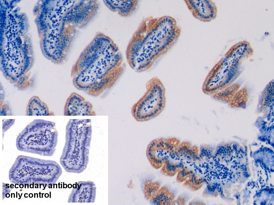 Polyclonal Antibody to Cytokeratin 20 (CK 20)