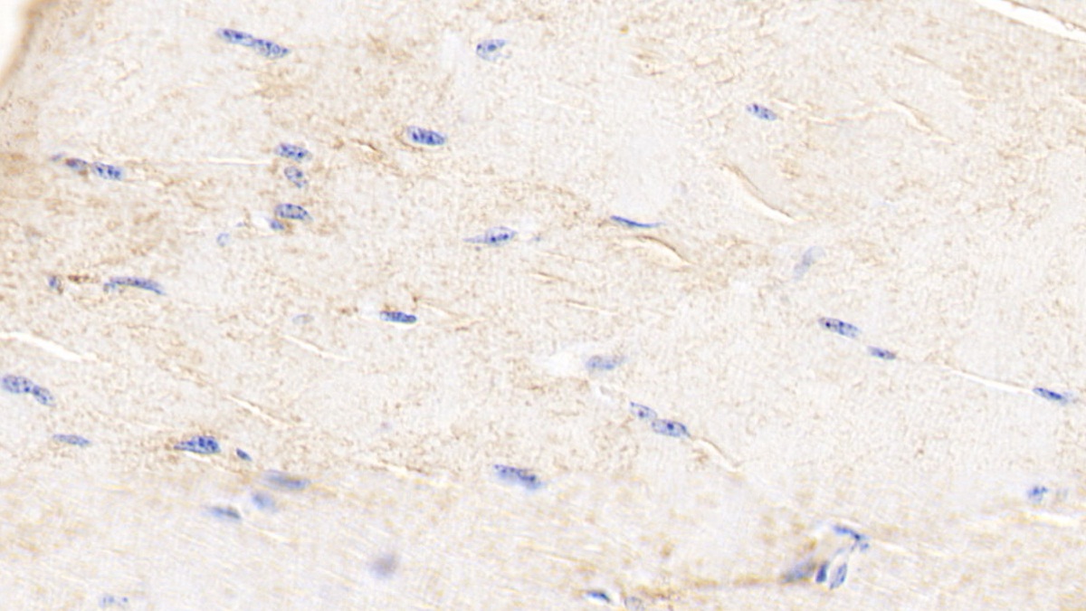 Polyclonal Antibody to Heart-type Fatty Acid Binding Protein (H-FABP)