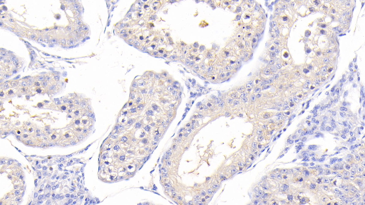 Polyclonal Antibody to Heart-type Fatty Acid Binding Protein (H-FABP)