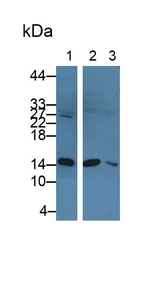 Polyclonal Antibody to Heart-type Fatty Acid Binding Protein (H-FABP)