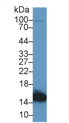 Polyclonal Antibody to Heart-type Fatty Acid Binding Protein (H-FABP)