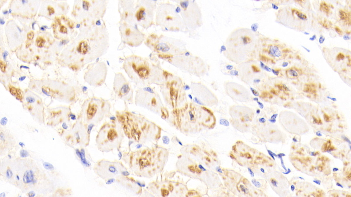 Polyclonal Antibody to Heart-type Fatty Acid Binding Protein (H-FABP)