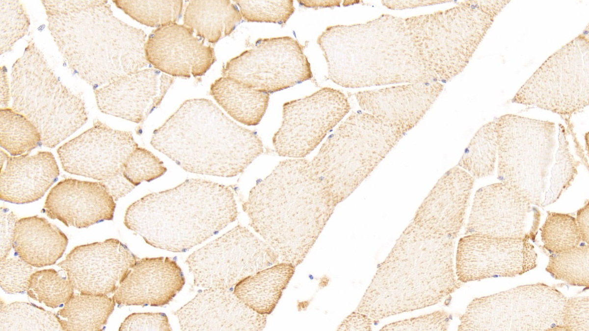 Polyclonal Antibody to Heart-type Fatty Acid Binding Protein (H-FABP)