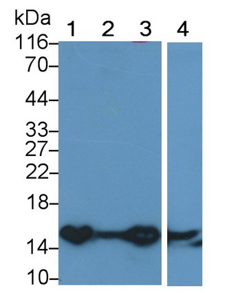 Polyclonal Antibody to Heart-type Fatty Acid Binding Protein (H-FABP)