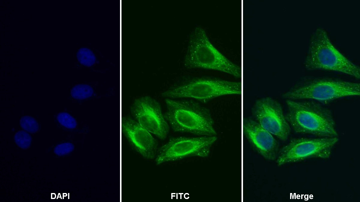 Polyclonal Antibody to Heart-type Fatty Acid Binding Protein (H-FABP)