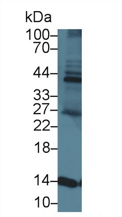 Polyclonal Antibody to Heart-type Fatty Acid Binding Protein (H-FABP)