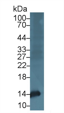 Polyclonal Antibody to Heart-type Fatty Acid Binding Protein (H-FABP)