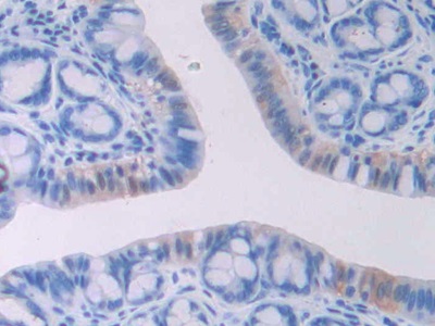 Polyclonal Antibody to Heart-type Fatty Acid Binding Protein (H-FABP)