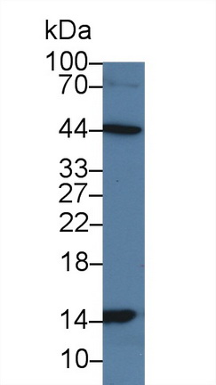 Polyclonal Antibody to Heart-type Fatty Acid Binding Protein (H-FABP)