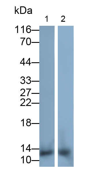 Polyclonal Antibody to Heart-type Fatty Acid Binding Protein (H-FABP)