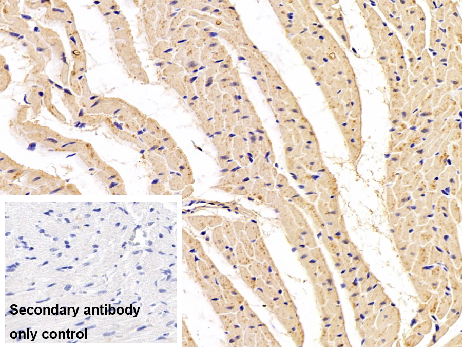 Polyclonal Antibody to Heart-type Fatty Acid Binding Protein (H-FABP)