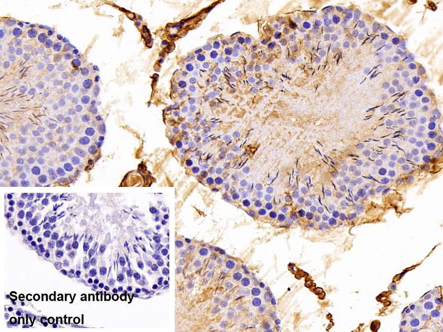 Polyclonal Antibody to Heart-type Fatty Acid Binding Protein (H-FABP)