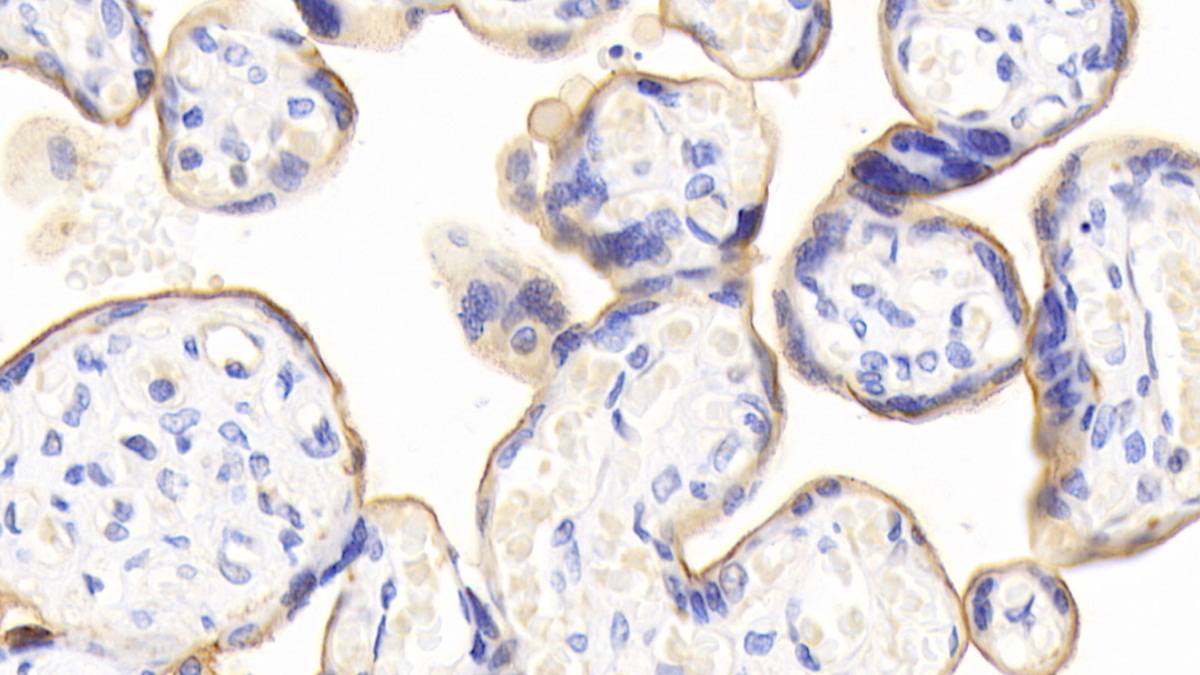 Polyclonal Antibody to Cluster Of Differentiation 73 (CD73)