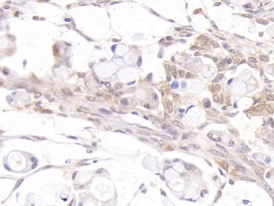 Polyclonal Antibody to Androgen Receptor (AR)