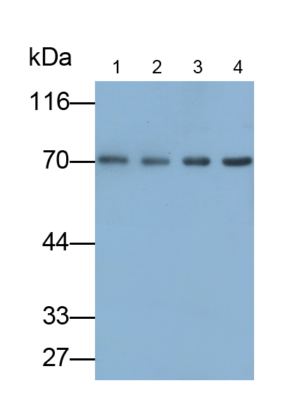 Polyclonal Antibody to Androgen Receptor (AR)
