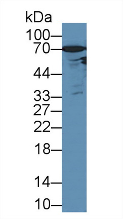 Polyclonal Antibody to Androgen Receptor (AR)