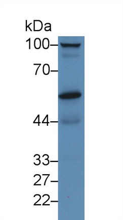 Polyclonal Antibody to Prolylcarboxypeptidase (PRCP)