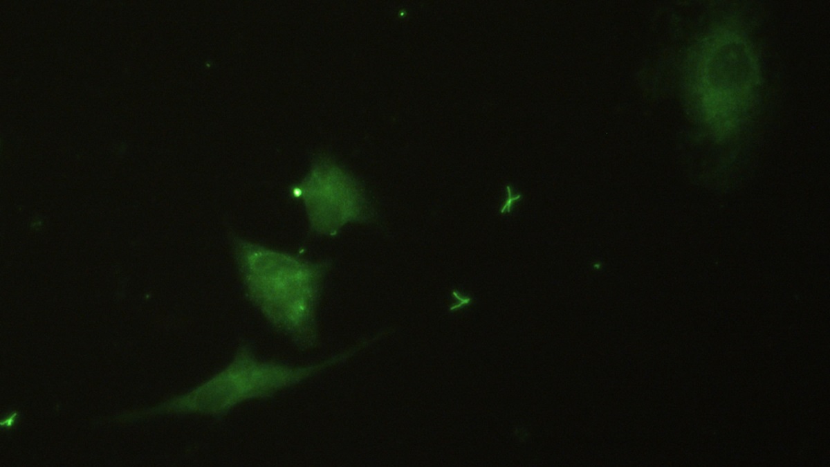 Polyclonal Antibody to Integrin Beta 3 (ITGb3)