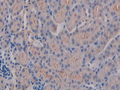 Polyclonal Antibody to Integrin Beta 3 (ITGb3)