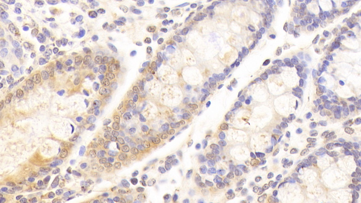 Polyclonal Antibody to Kininogen 1 (KNG1)